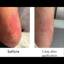 BDR Boswellia Booster – Intensiv hudvård för irritation och rodnad.