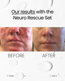 ONLINE KURS i Medicinsk microneedling med BDR Skinstyler apparat + produkt Kit