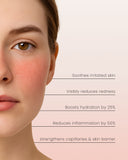 ONLINE KURS i Medicinsk microneedling med BDR Skinstyler apparat + produkt Kit