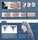 7D Hifu är mikro- och makrofokuserad ultraljudsmaskin (MMFU) Ny