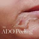 ADO peeling