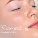 Klassisk och djup micrineedling kurs