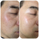 Dm.Cell 9GF BTX 18% Ampoule